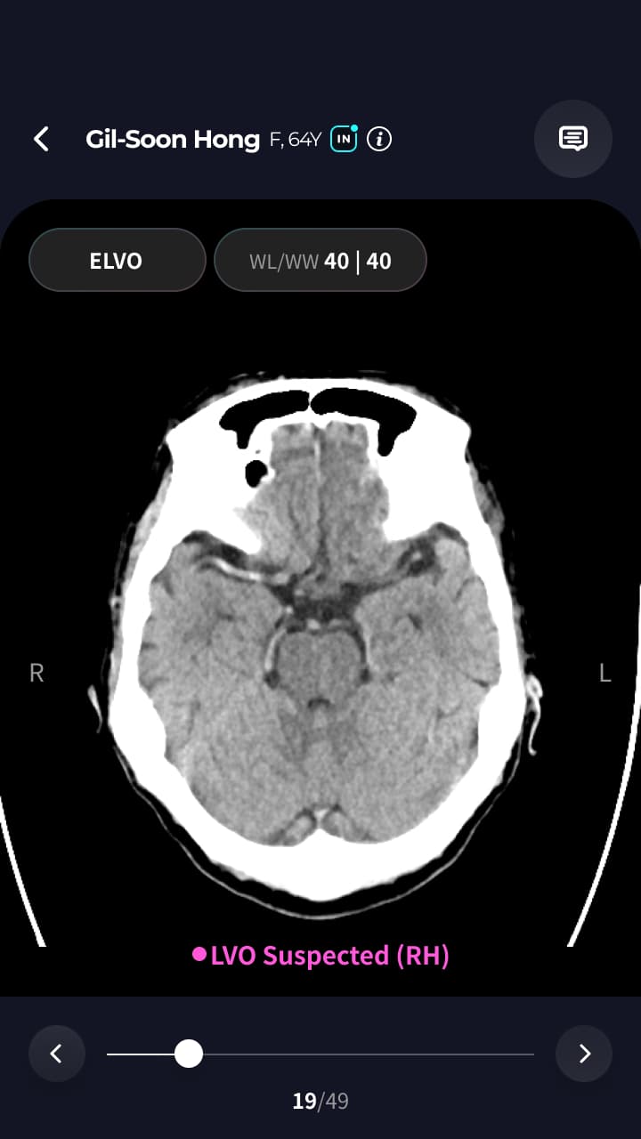 휴런 Strocare Suite Mobile 썸네일 3